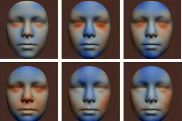 Facial development linked to alcohol consumption