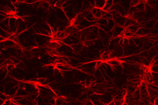 brain astrocytes