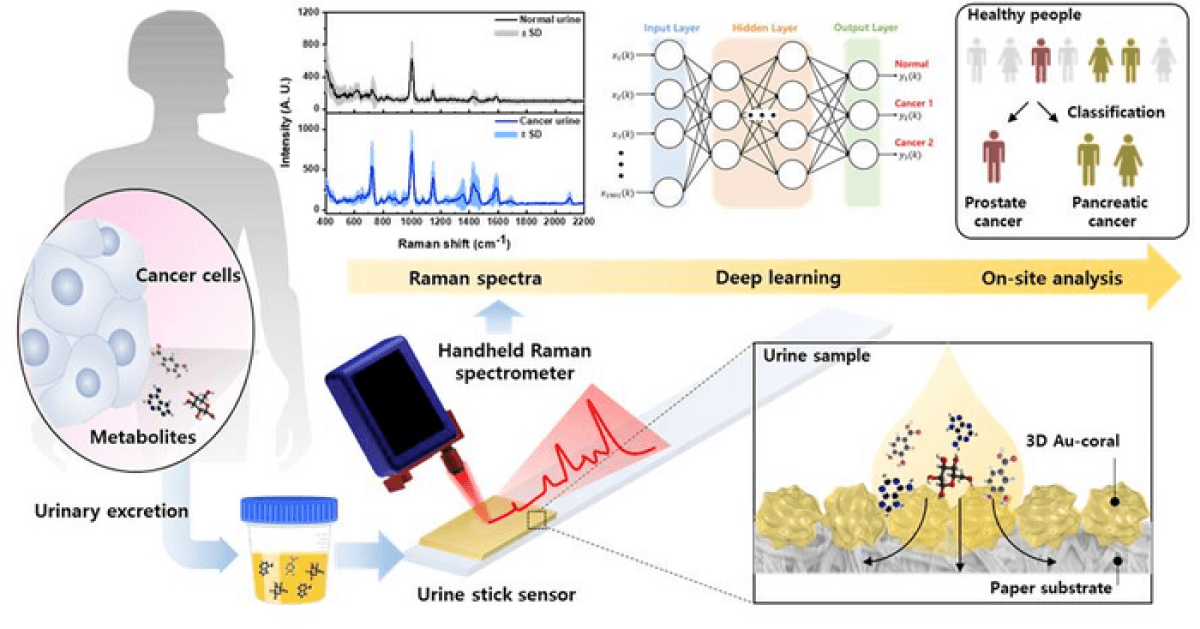 Cancer detection test using urine