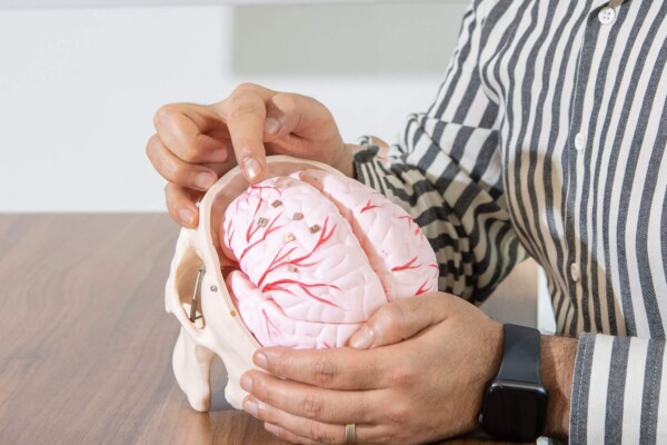 Micro robots sitting on a model of the human brain