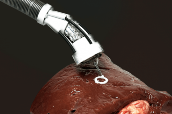 3d bioprinting on the surface of a kidney