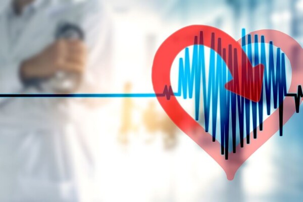 atrial fibrillation, cardiac arrhythmia, heart