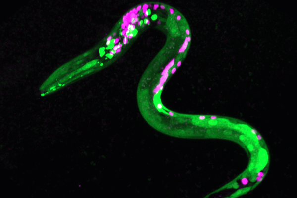 Image of worm that is genetically engineered so that certain neurons and muscles are fluorescent