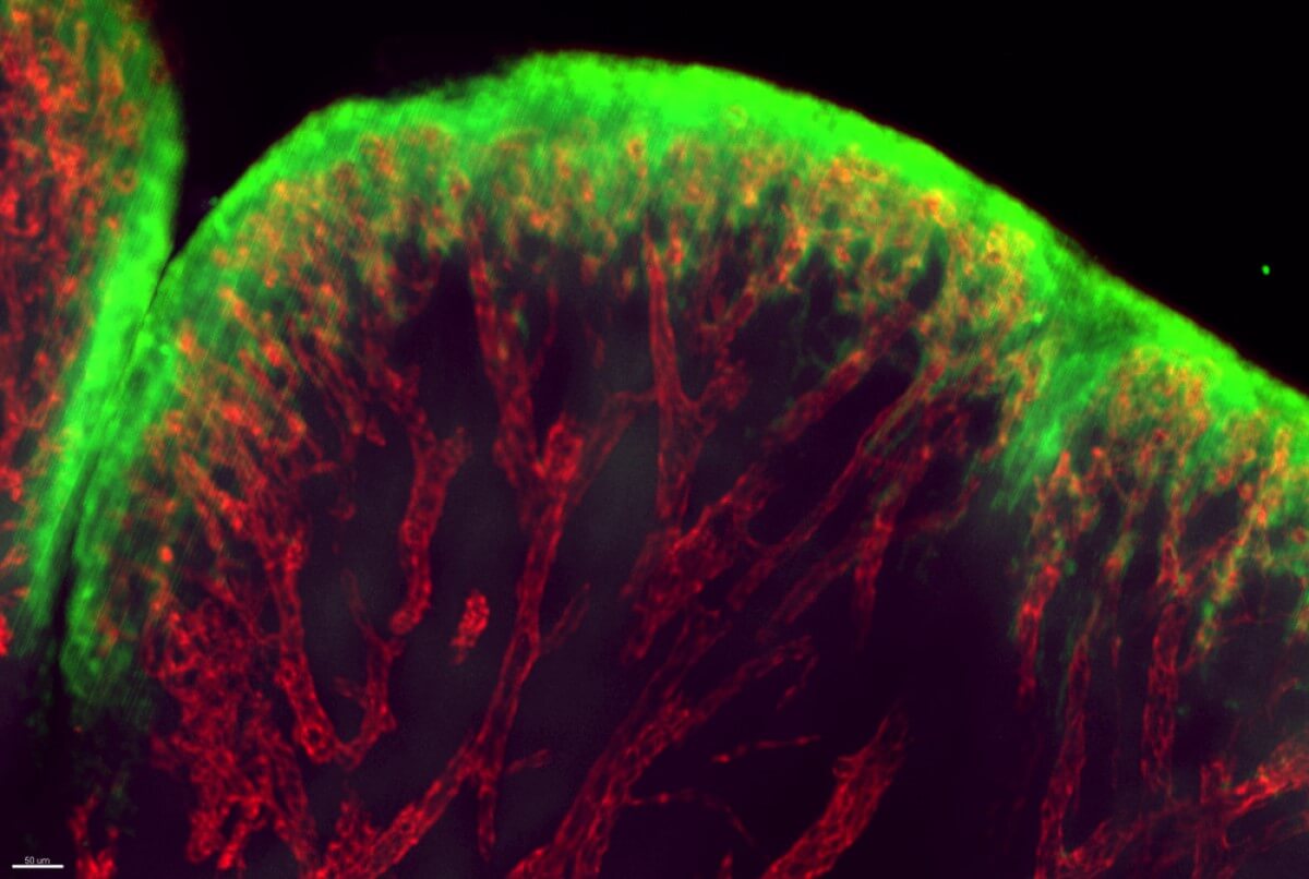 blood vessels during an arthritis flare up