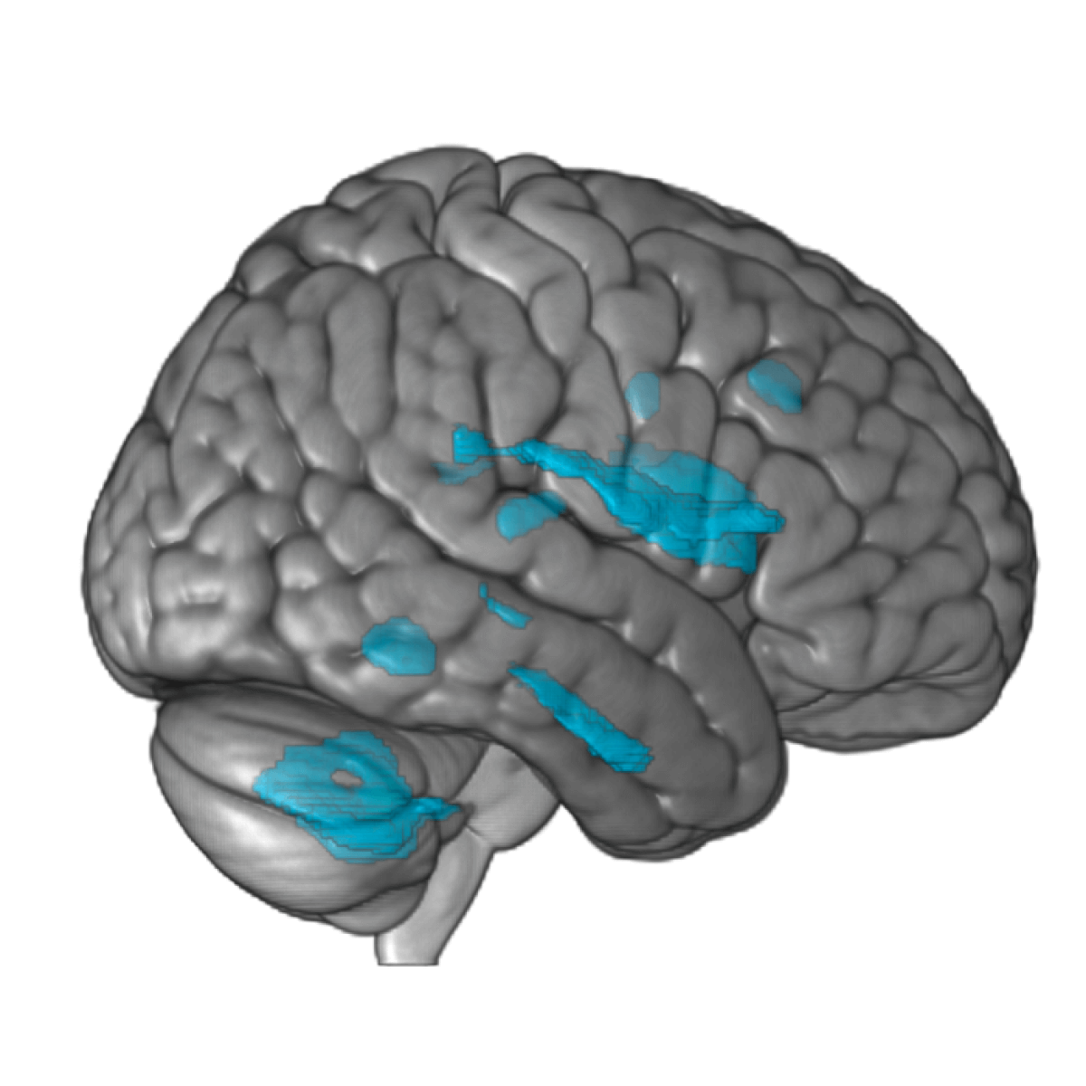 music's effects on brain grey matter