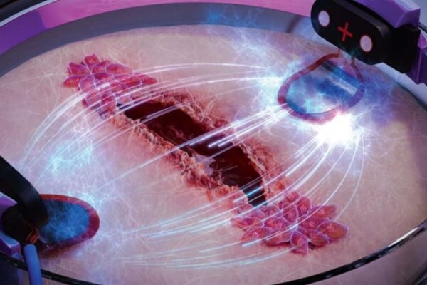 Illustration of wound healing using electricity