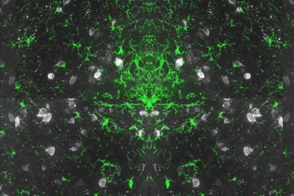 Grand Prize Winner of the 2023 Endocrine Images Art Competition shows microglia (green) and POMC neurons (gray)