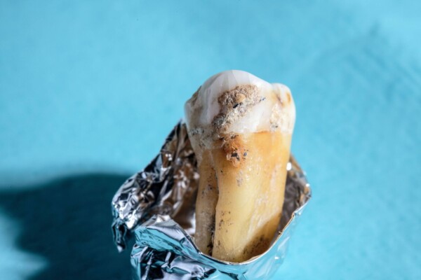 Ancient microbes on a prehistoric tooth