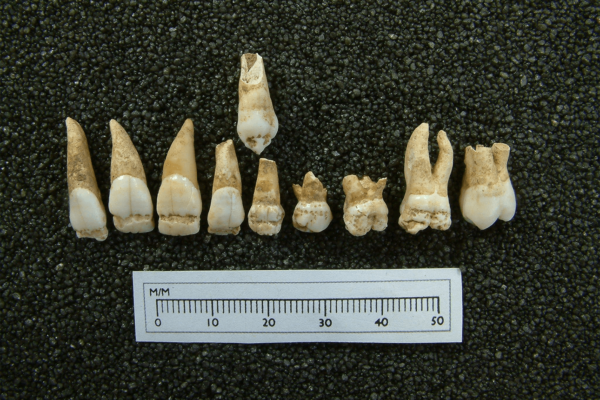 dental remains of child laborers
