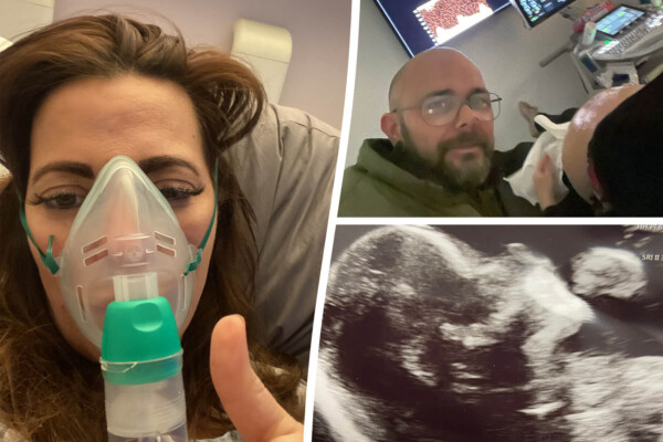 A pregnant mom delighted to see her unborn baby kicking her legs on a scan after tricky spinal surgery while she was inside the womb.