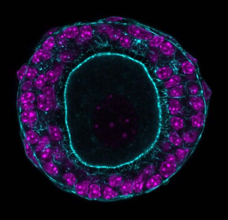 Confocal image of a secondary ovarian follicle from the 2023 Endocrine Images Art Competition