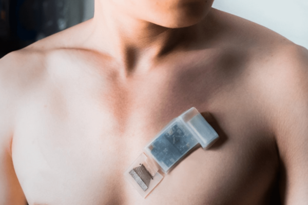 wireless ultrasound patch