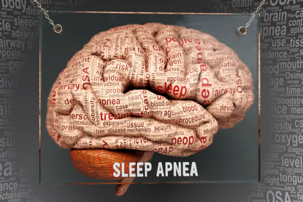 Sleep apnea brain anatomy