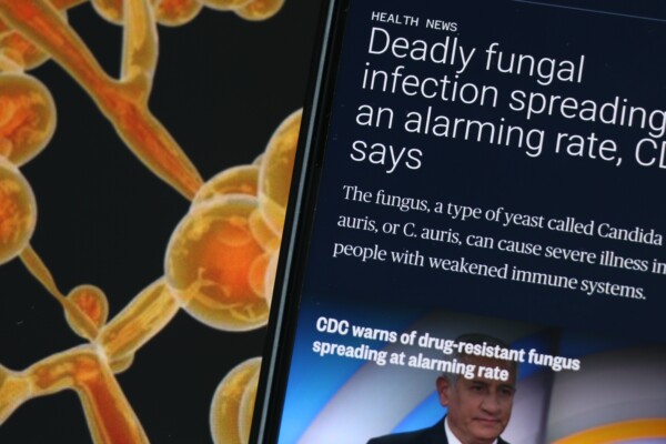 News article warning of spread of Candida auris (C. auris).
