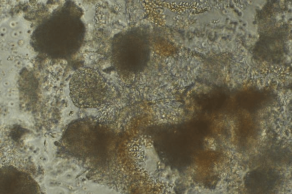 Cardiomyocytes