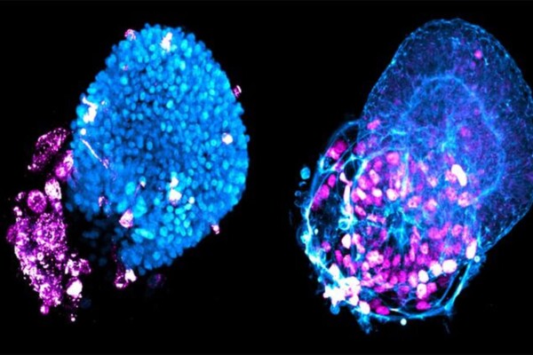 SARS-CoV-2 (magenta) infects alveolar and airway tissues (blue) of human mini-lungs derived in vitro from human pluripotent stem cells.