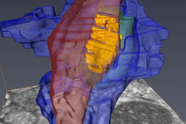 See through 3D model that shows the axon (red), medium spinal motor neuron (green), and astrocyte converging at the synapse (yellow).