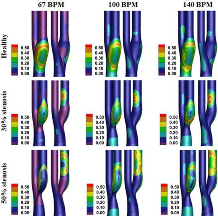 heart arteries during exercise