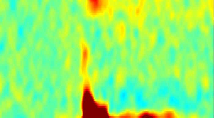 gamma brain waves
