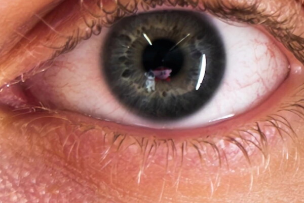 Toy dog seen in eye reflection.