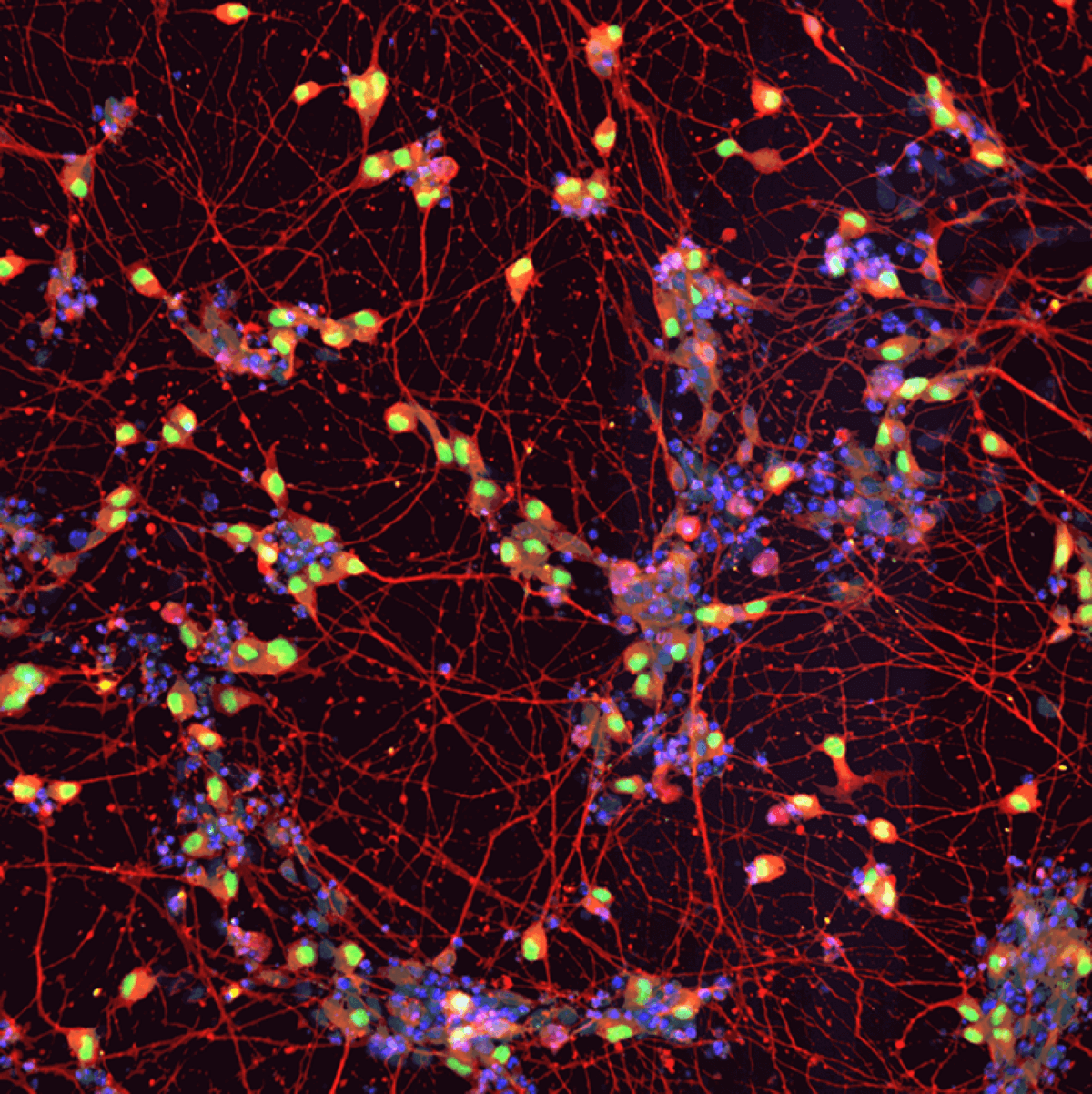 motor neurons ALS