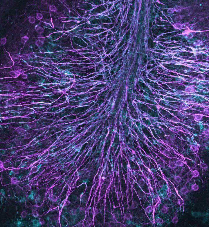 myelin axons