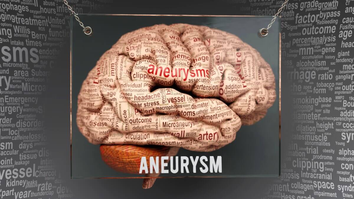 Aneurysm brain