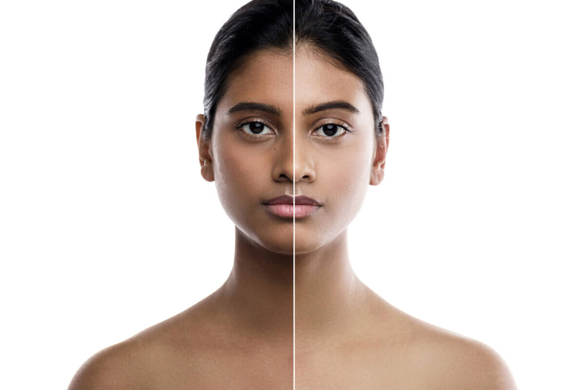skin whitening treatment