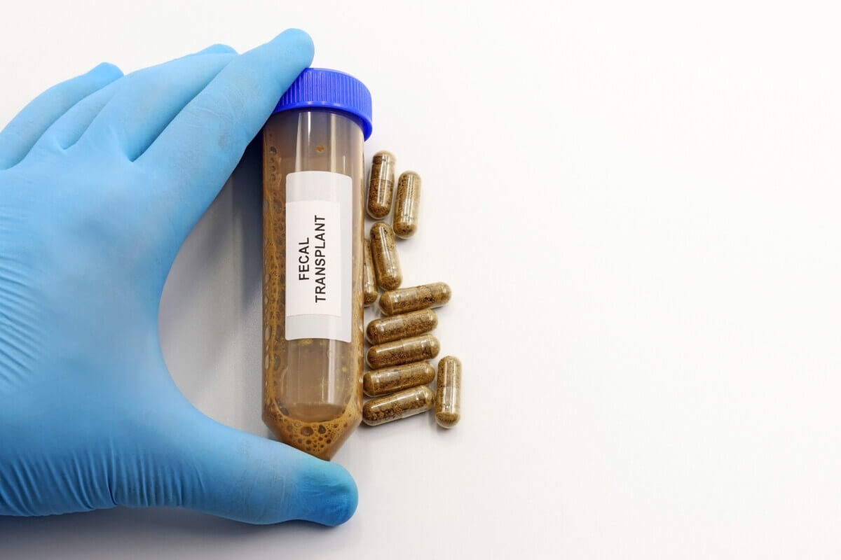 Fecal transplant