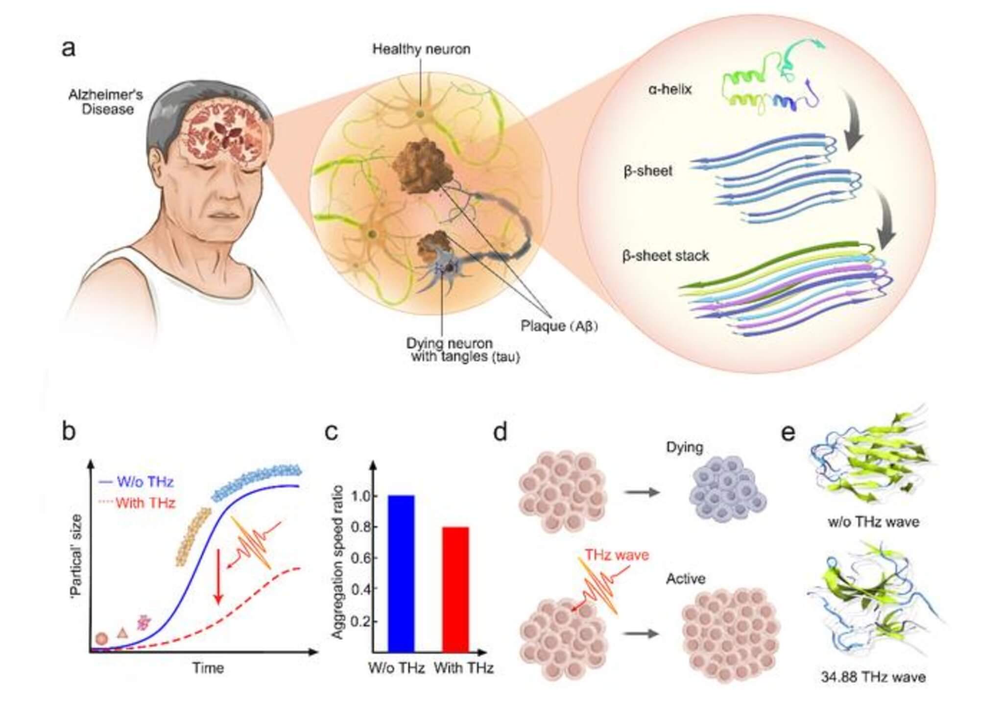 The presence of extracellular β-amyloid deposition as neuritic plaques and the intracellular accumulation of hyperphosphorylated tau as neuro fibrillary tangles remain the primary neuropathologic features for AD diagnosis, and the amyloid deposition begins with the conversion of native monomers with more α-helices to an alternative conformation with β-sheet that self-associate into ordered assemblies