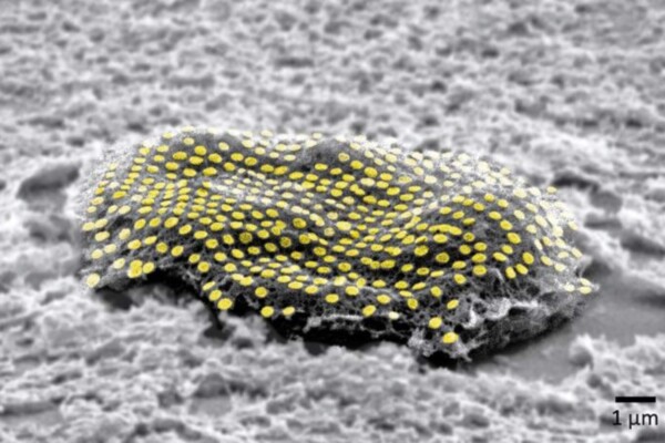 False-colored gold nanodot array on a fibroblast cell