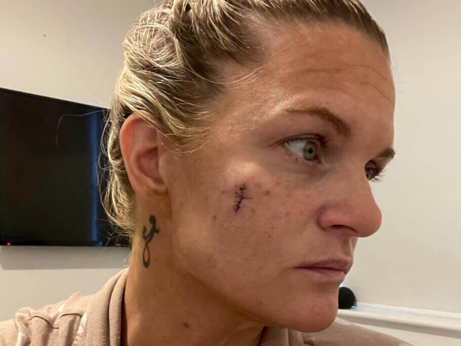 Woman skin cancer