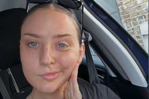Woman sitting in a car taking a selfie to show paralysis in half of her face.