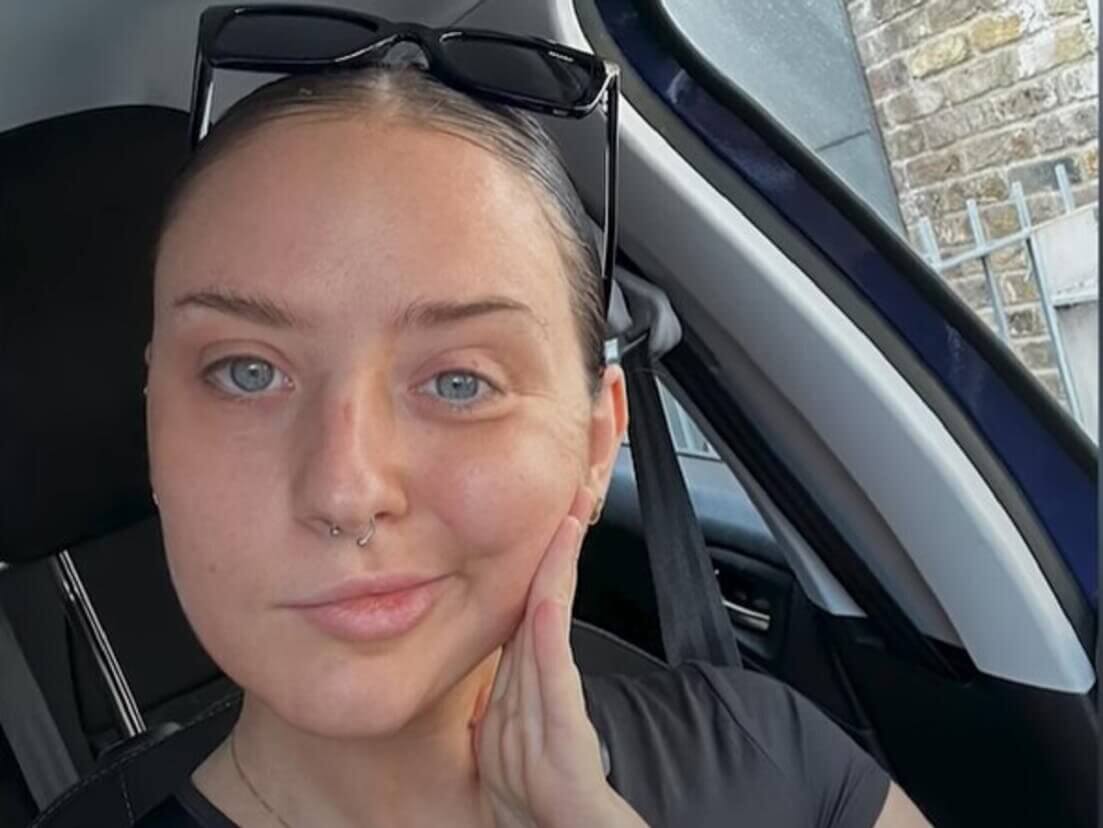 Caoimhe Reddy Face Paralysis
