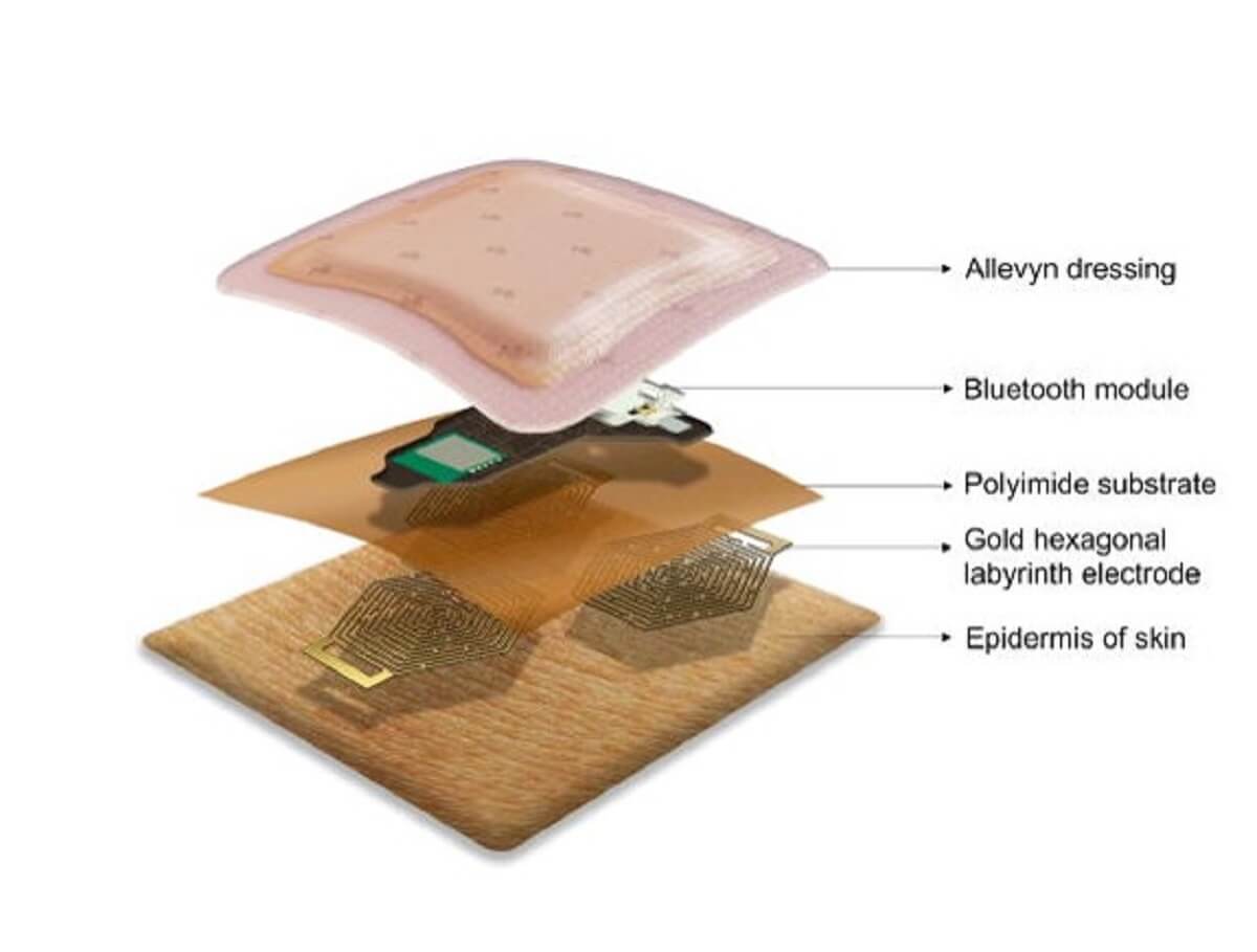 Schematic of the wearable and wireless dry electrode ECG device attached onto the skin.