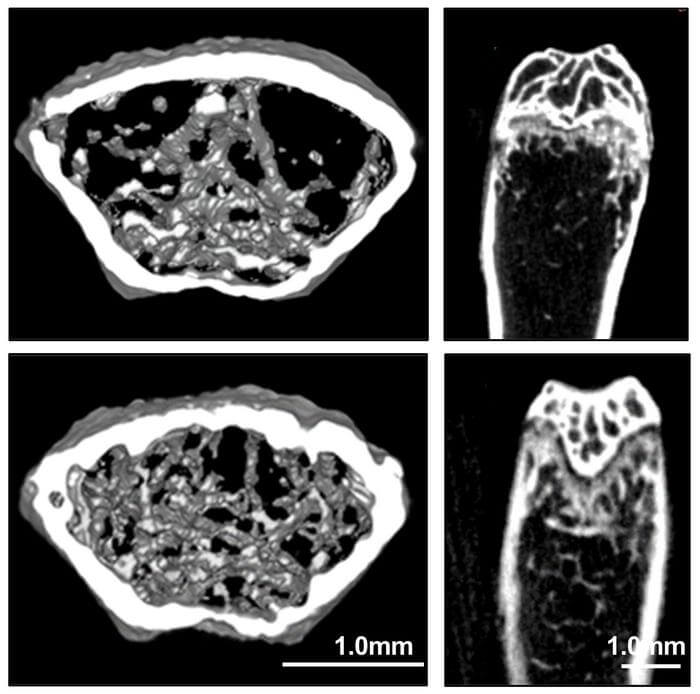 Osteoporotic mice treated with dihydroartemisinin (DHA) had significantly improved bone density (bottom) compared to controls (top).