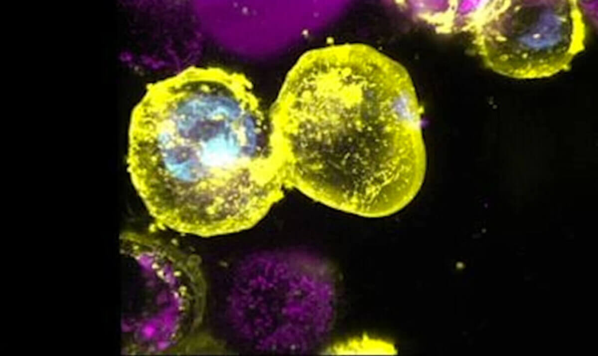 cell death