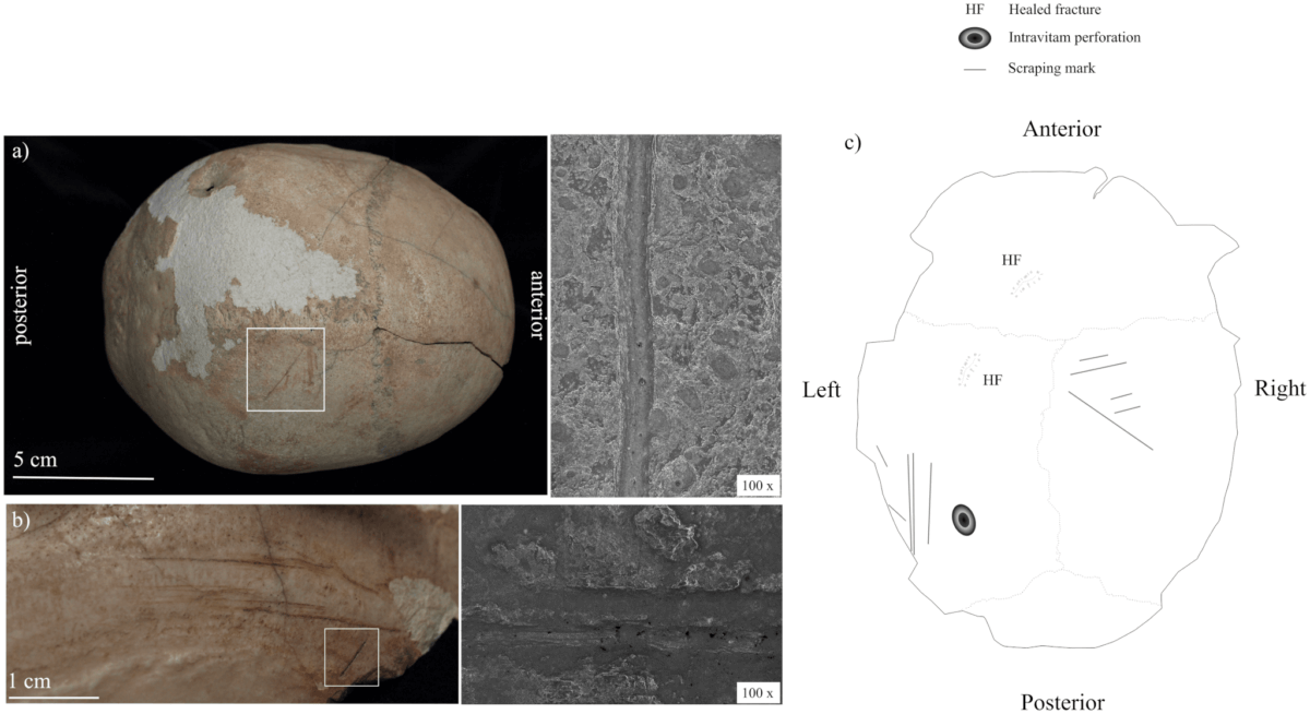 Examples of scraping marks on the skull cup