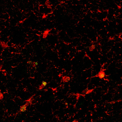 an old mouse that was treated with PF4 has less brain 