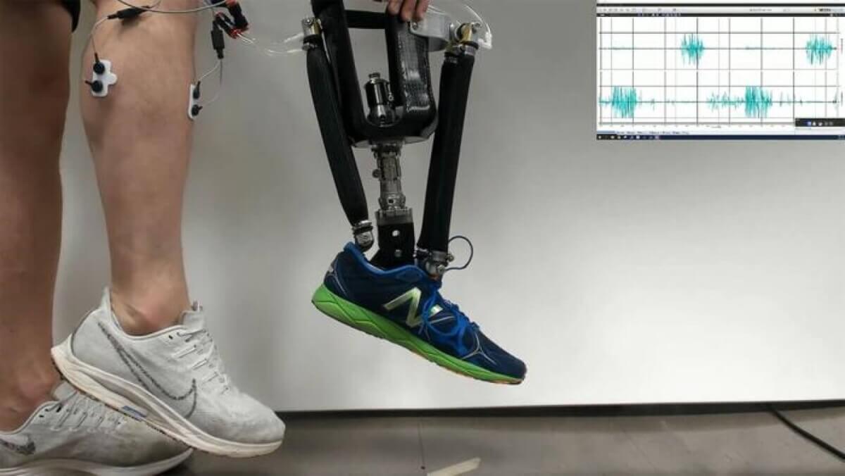 prosthetic ankle
