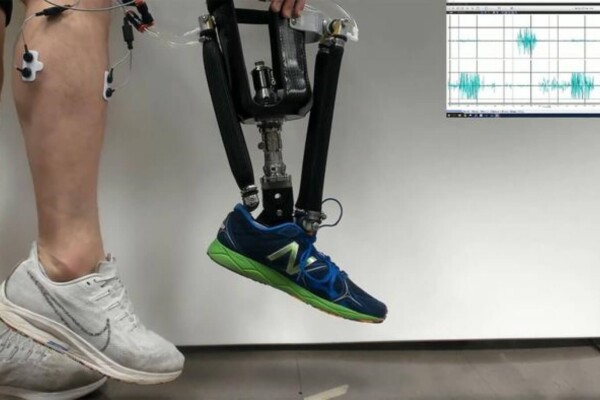prosthetic ankle