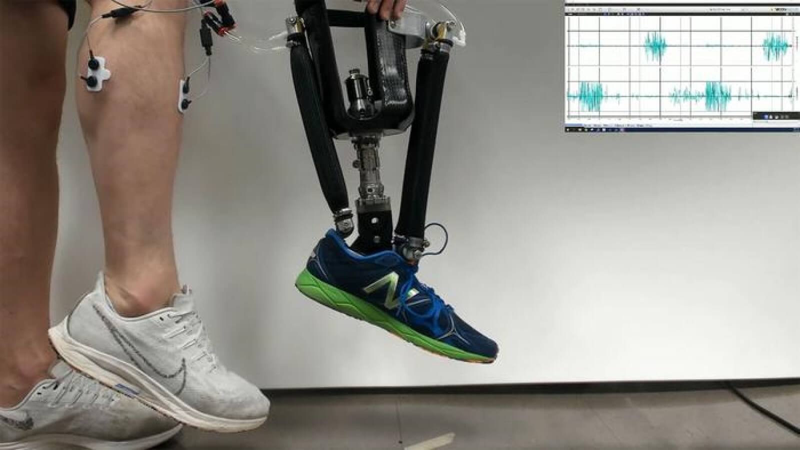 prosthetic ankle