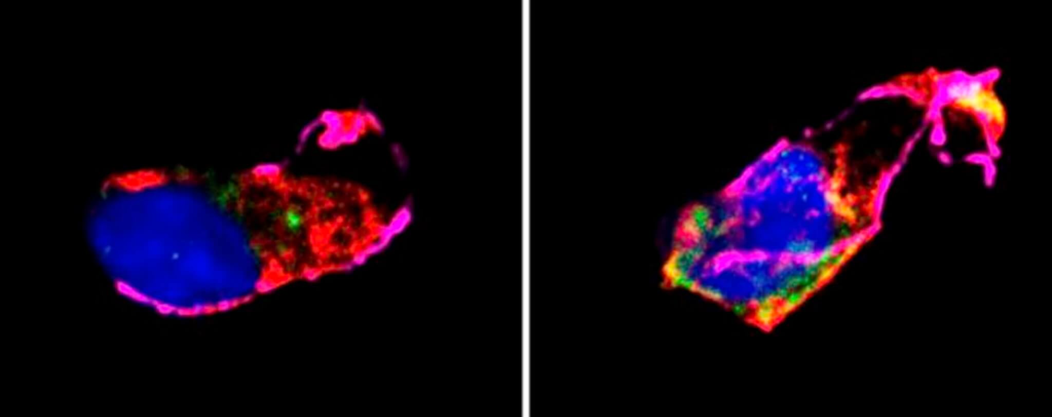 The researchers traced the absence of the antioxidant response in sleep-deprived cells to a cellular factor, NRF2, that becomes trapped in the cytoplasm