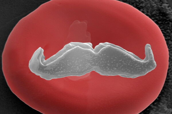 The world's tiniest mustache as seen on a red blood cell.