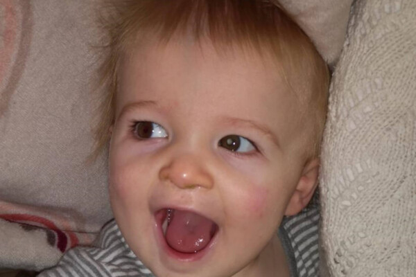 child with eye cancer