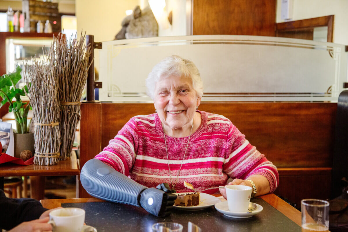 oldest person bionic arm