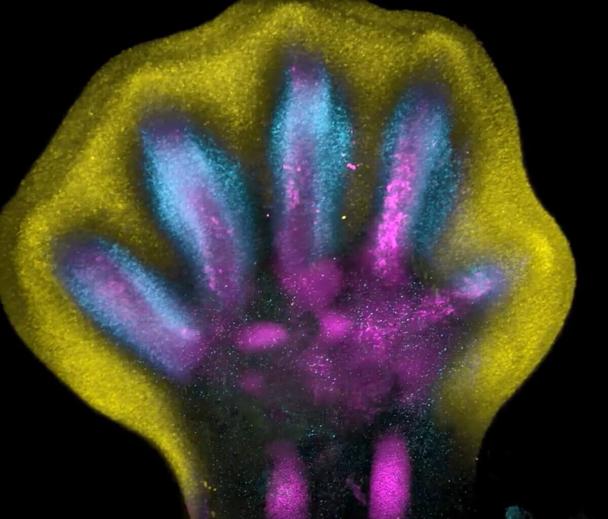 first map of human limb development
