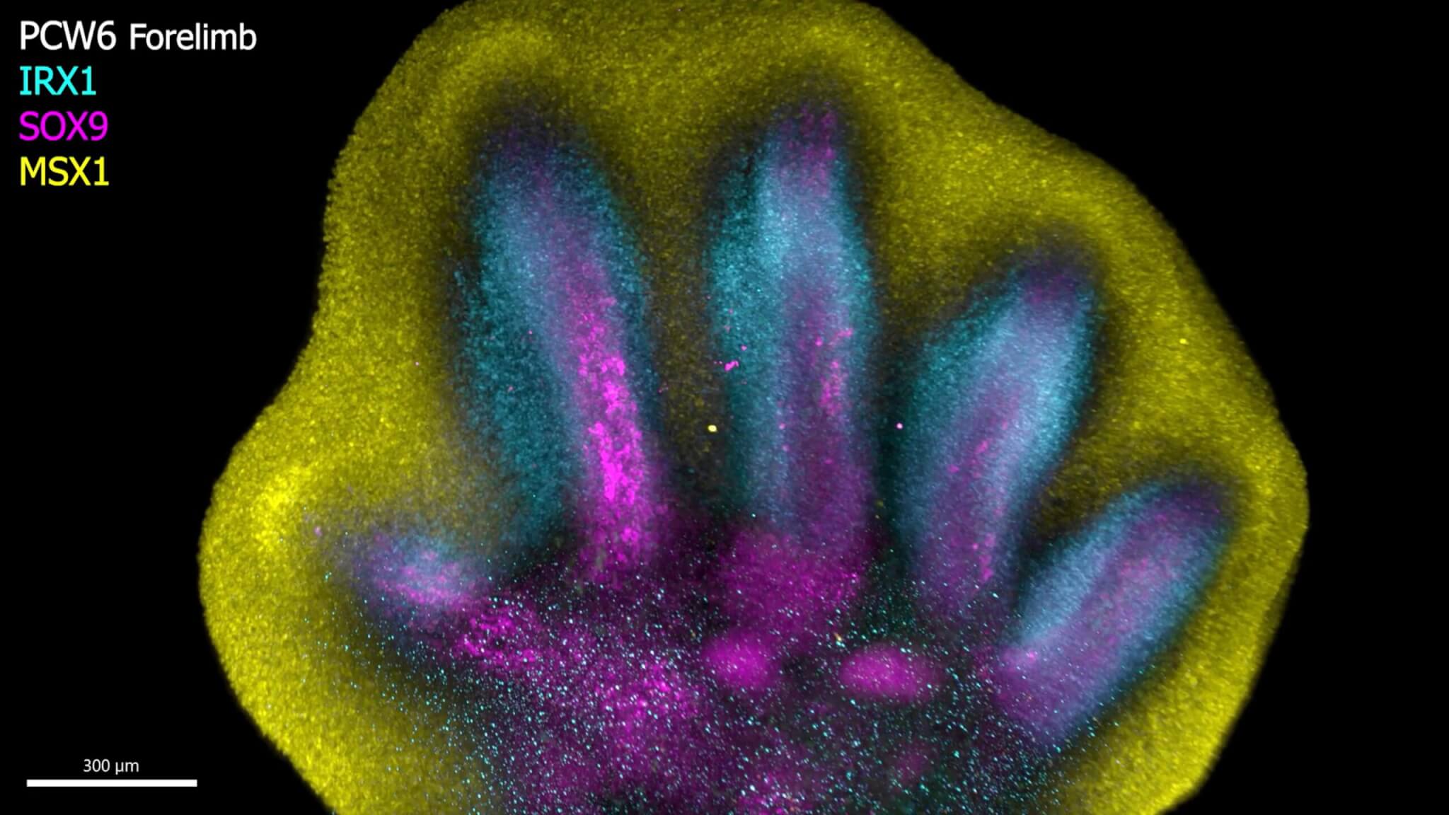 first map of human limb development