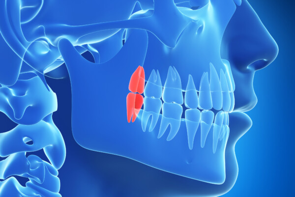 3d rendered illustration of the wisdom teeth