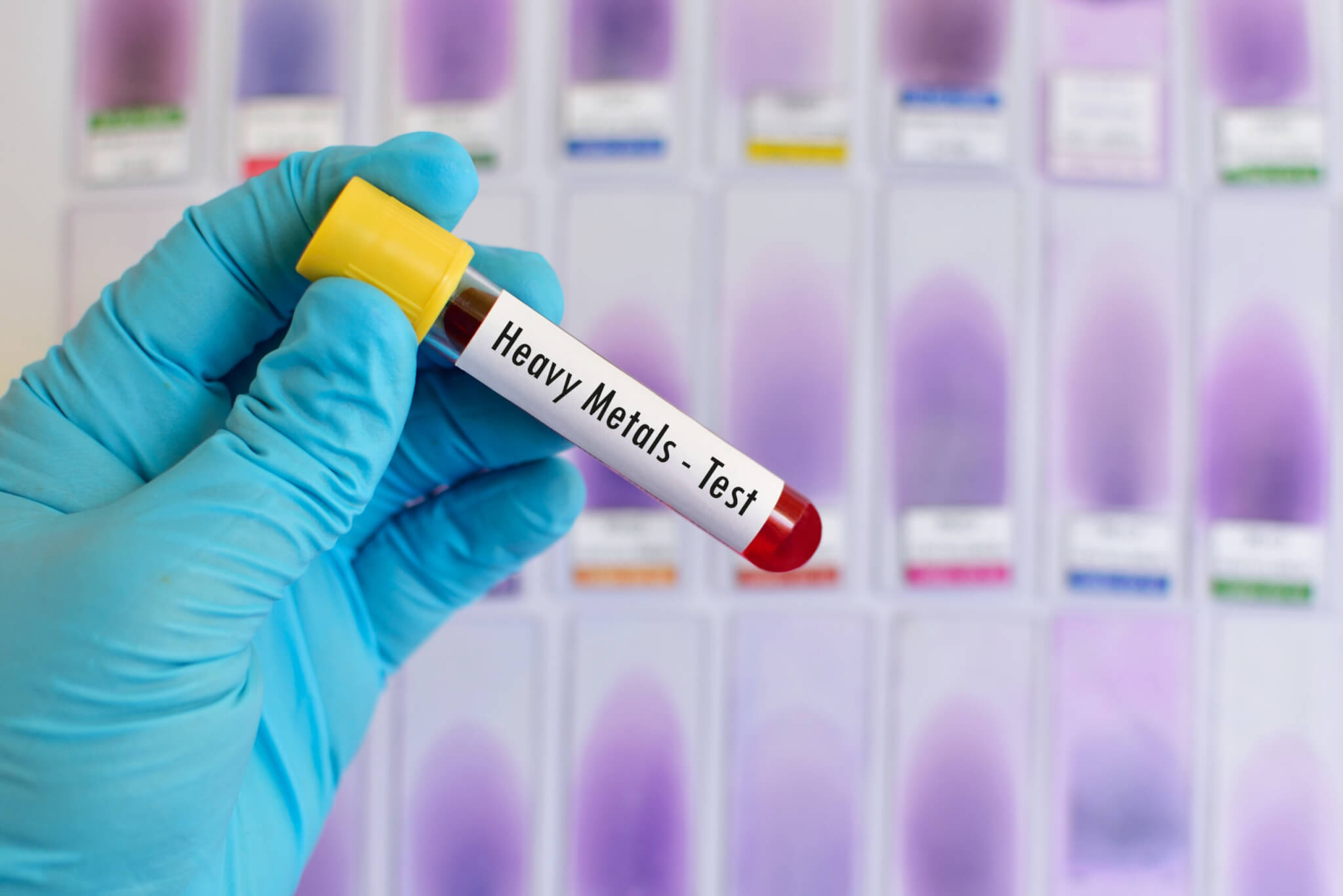 Heavy metals blood test